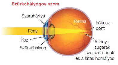 egészséges látás természetesen)